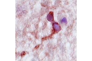 Human Hippocampus; CPLX2 antibody - N-terminal region in Human Hippocampus cells using Immunohistochemistry