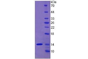 SDS-PAGE of Protein Standard from the Kit  (Highly purified E. (ALT ELISA Kit)