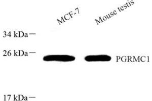 Western blot analysis of PGRMC1 (ABIN7075182) at dilution of 1: 800 (PGRMC1 antibody)