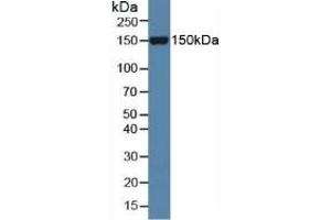 Rabbit Capture antibody from the kit in WB with Positive Control: Sample Mouse serum.