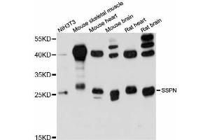 Western blot analysis of extracts of various cell lines, using SSPN antibody (ABIN5998966) at 1:3000 dilution.
