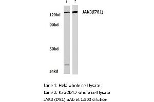 Western blot (WB) analysis of JAK3 antibody  in extracts from hela and raw264.