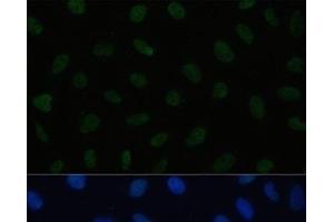 Immunofluorescence analysis of U2OS cells using HSF1 Polyclonal Antibody at dilution of 1:100. (HSF1 antibody)