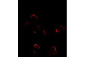 anti-Golgin A2 (GOLGA2) (N-Term) antibody