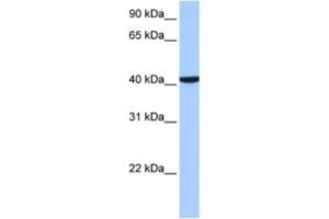 Western Blotting (WB) image for anti-Coiled-Coil and C2 Domain Containing 1B (CC2D1B) antibody (ABIN2463517) (CC2D1B antibody)