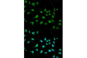 Immunofluorescence analysis of MCF7 cell using BMPR1B antibody. (BMPR1B antibody  (AA 1-126))