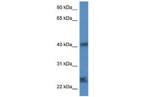 WB Suggested Anti-Scamp1 Antibody Titration: 1.