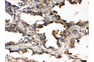 Immunohistochemistry (Paraffin-embedded Sections) (IHC (p)) image for anti-Ubiquitin-Conjugating Enzyme E2Q Family Member 2 (UBE2Q2) (AA 83-123), (N-Term) antibody (ABIN3043953) (UBE2Q2 antibody  (N-Term))