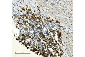 IHC analysis of CD20/MS4A1 using anti-CD20/MS4A1 antibody (ABIN7599233).