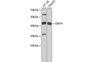 Western blot analysis of extracts of various cell lines, using DPEP1 antibody (ABIN6130950, ABIN6139781, ABIN6139782 and ABIN6221888) at 1:1000 dilution. (DPEP1 antibody  (AA 17-385))