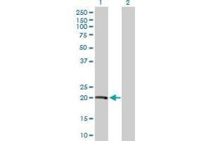 Western Blot analysis of VHL expression in transfected 293T cell line by VHL MaxPab polyclonal antibody. (VHL antibody  (AA 1-172))