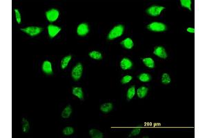 Immunofluorescence of monoclonal antibody to SFRS17A on HeLa cell. (SFRS17A antibody  (AA 53-156))