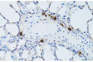 Immunohistochemistry of paraffin-embedded Rat lung using TEFM Polyclonal Antibody at dilution of 1:100 (40x lens).