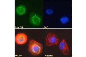 Immunofluorescence (IF) image for anti-Autoimmune Regulator (AIRE) (C-Term) antibody (ABIN184780)