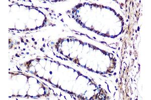 Immunohistochemistry of paraffin-embedded human colon using JNK1/JNK3 Rabbit mAb (ABIN1678909, ABIN7101754, ABIN7101755 and ABIN7101756) at dilution of 1:100 (40x lens). (JNK antibody)