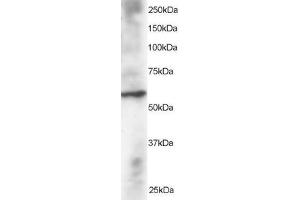 Western Blotting (WB) image for anti-Dual Specificity Phosphatase 8 (DUSP8) (N-Term) antibody (ABIN2465625) (DUSP8 antibody  (N-Term))