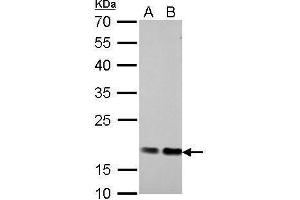 WB Image Cofilin 1 antibody detects CFL1 protein by Western blot analysis. (Cofilin antibody)