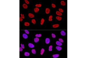 Confocal immunofluorescence analysis of U2OS cells using KHDRBS1/Sam68 Polyclonal Antibody (ABIN6133782, ABIN6142829, ABIN6142830 and ABIN6221707) at dilution of 1:400. (KHDRBS1 antibody  (C-Term))