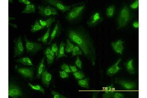 Immunofluorescence (IF) image for anti-serum/glucocorticoid Regulated Kinase 1 (SGK1) (AA 1-431) antibody (ABIN562849)