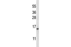 BAFF antibody western blot analysis in K562 lysate. (TNFRSF13C antibody  (AA 1-30))