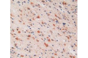 Used in DAB staining on fromalin fixed paraffin- embedded glioma tissue (PSMC6 antibody  (AA 2-403))