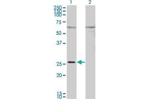Western Blot analysis of GAP43 expression in transfected 293T cell line by GAP43 monoclonal antibody (M01), clone 3C11. (GAP43 antibody  (AA 1-238))