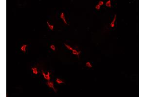 ABIN6266812 staining CACO-2 cells by IF/ICC. (ELF1 antibody  (C-Term))