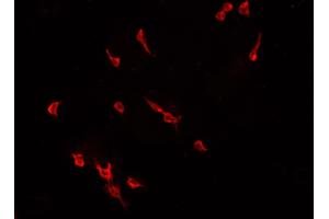 ABIN6266812 staining CACO-2 cells by IF/ICC.