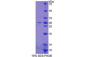 SDS-PAGE analysis of Rat GPX6 Protein. (Glutathione Peroxidase 6 Protein (GPX6))