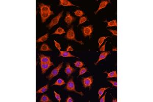 Immunofluorescence analysis of L929 cells using D Rabbit pAb (ABIN6127743, ABIN6139383, ABIN6139384 and ABIN6223348) at dilution of 1:100. (DAAM2 antibody  (AA 1-86))