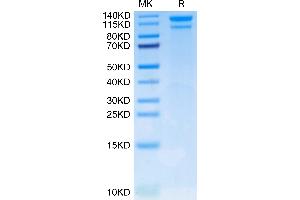 LDLR Protein (AA 22-788) (His-Avi Tag)
