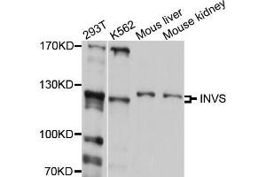 Western blot analysis of extracts of various cell lines, using INVS antibody (ABIN5997996) at 1/1000 dilution.