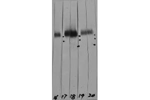 Western strip blots of HeLa cell crude extracts with two different preparations of ABIN1580432 in strips 17 and 18. (LAMP1 antibody)
