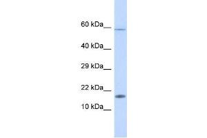 Human Fetal liver; WB Suggested Anti-HERC4 Antibody.