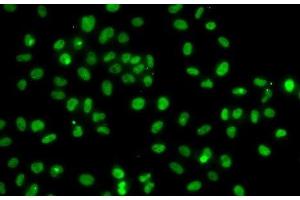Immunofluorescence analysis of A-549 cells using PMS2 Polyclonal Antibody (PMS2 antibody)