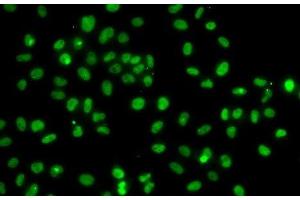Immunofluorescence analysis of A-549 cells using PMS2 Polyclonal Antibody (PMS2 antibody)