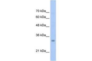 Western Blotting (WB) image for anti-High Mobility Group Nucleosome Binding Domain 5 (HMGN5) antibody (ABIN2461600)