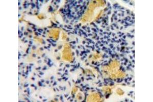 #VALUE! (PGLYRP1 antibody  (AA 19-182))