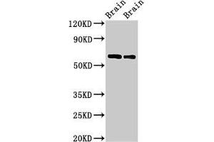 Western Blot Positive WB detected in: Rat brain tissue, Mouse brain tissue All lanes: CPNE4 antibody at 2 μg/mL Secondary Goat polyclonal to rabbit IgG at 1/50000 dilution Predicted band size: 63, 65 kDa Observed band size: 63 kDa