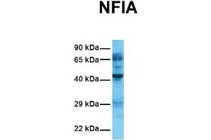 Host:  Rabbit  Target Name:  NFIA  Sample Tissue:  Human Fetal Lung  Antibody Dilution:  1. (NFIA antibody  (Middle Region))