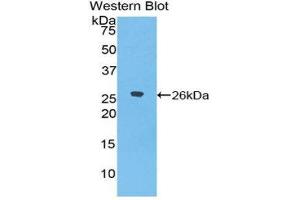 Western Blotting (WB) image for anti-Epiphycan (EPYC) (AA 110-317) antibody (ABIN1858734) (EPYC antibody  (AA 110-317))