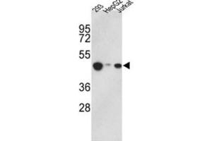 Western Blotting (WB) image for anti-Histone Aminotransferase 1 (HAT1) antibody (ABIN2995847) (HAT1 antibody)