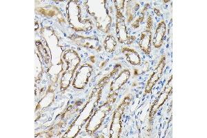 Immunohistochemistry of paraffin-embedded Rat kidney using CALCA antibody (ABIN7266005) at dilution of 1:100 (40x lens). (CGRP antibody  (AA 1-141))