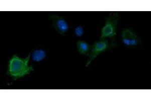Image no. 3 for anti-Parvin, alpha (PARVA) antibody (ABIN1496445) (Parvin alpha antibody)