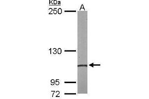 Western Blotting (WB) image for anti-Actinin, alpha 4 (ACTN4) (C-Term) antibody (ABIN2855119)