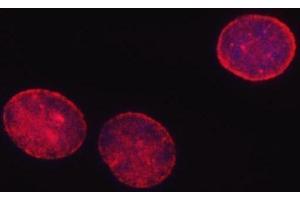 IF analysis of SHQ1 using anti-SHQ1 antibody (ABIN7599205). (SHQ1 antibody  (AA 1-277))