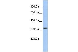 WB Suggested Anti-FGF13 Antibody Titration: 0.