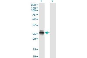 Western Blot analysis of KLK4 expression in transfected 293T cell line by KLK4 monoclonal antibody (M09), clone 2A4. (Kallikrein 4 antibody  (AA 159-254))