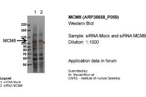 MCM8 WB Sample: siRNA Mock and siRNA MCM8 Dilution 1:1000 (MCM8 antibody  (N-Term))