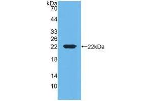 Detection of Recombinant RBP4, Bovine using Monoclonal Antibody to Retinol Binding Protein 4 (RBP4) (RBP4 antibody  (AA 1-183))
